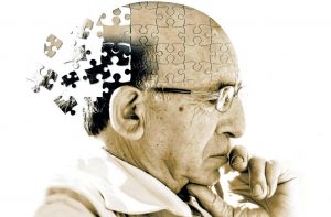 Alzheimer: O que é? Tratamento, Causas e Diagnostico