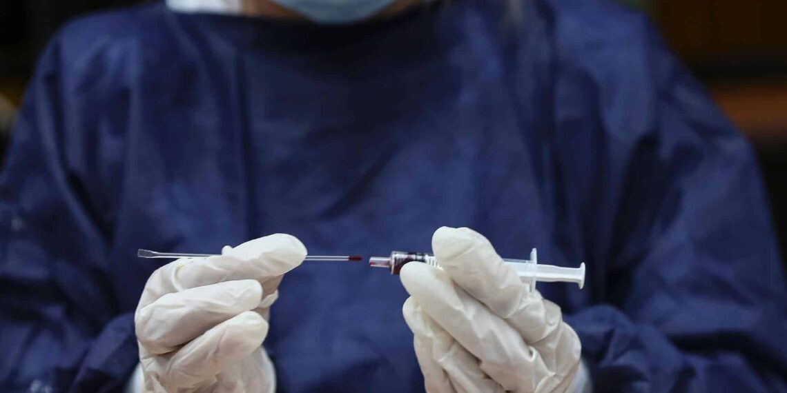 Anticoagulante reduz infecção de células pelo coronavírus em 70%