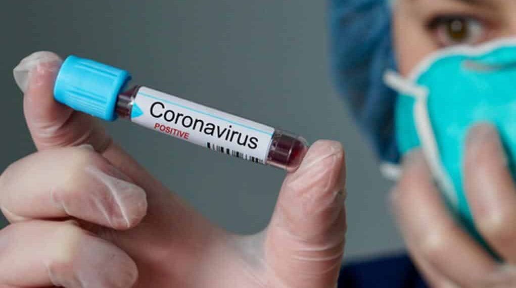 Cientista volta a discutir chance do coronavírus ter sido criado em laboratório