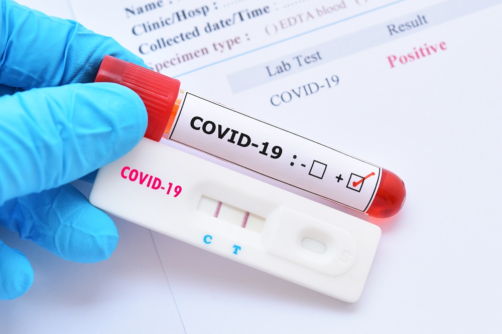 Covid-19: 9 situações que aprendemos ao longo da pandemia