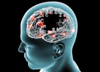 Covid-19 e Alzheimer: variante genética aumenta o risco das duas doenças