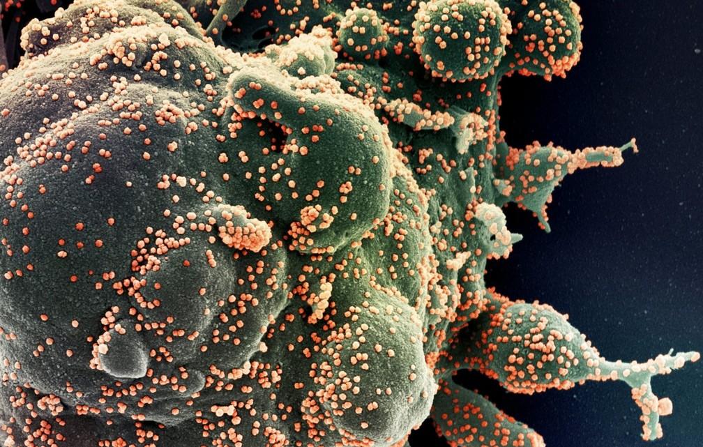 Imunidade contra o novo coronavírus pode ser duradoura, sugere estudo