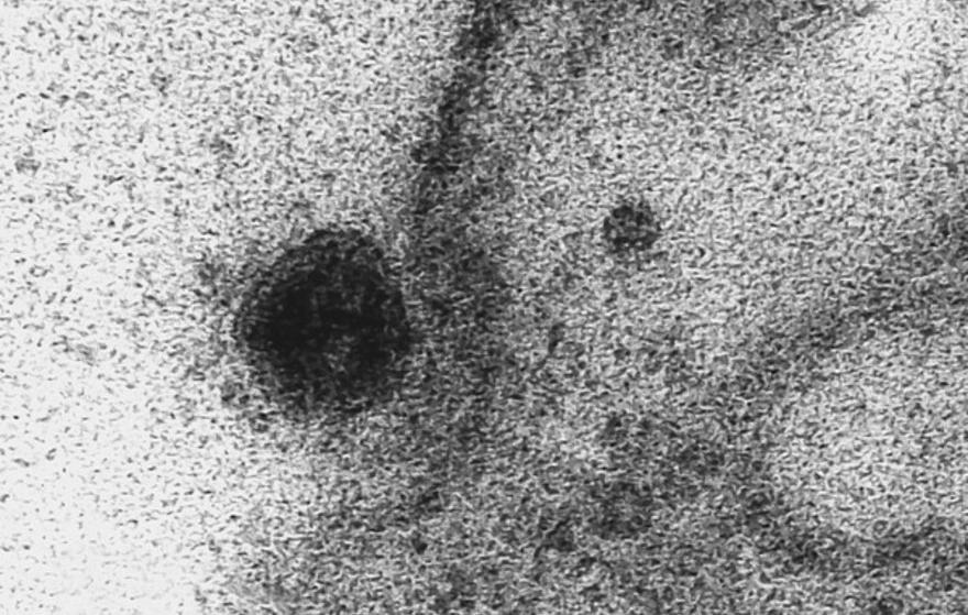 Mutação do novo coronavírus pode aumentar sua capacidade de infecção