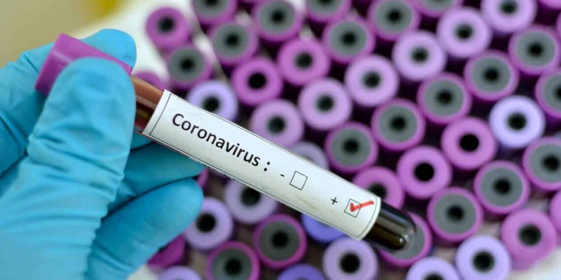 Rio de Janeiro registra duas mortes devido ao novo coronavírus