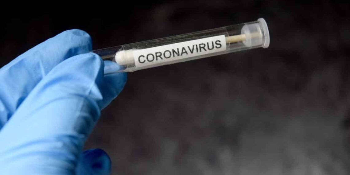 Testes rápidos de detecção do coronavírus podem ser até 75% falhos